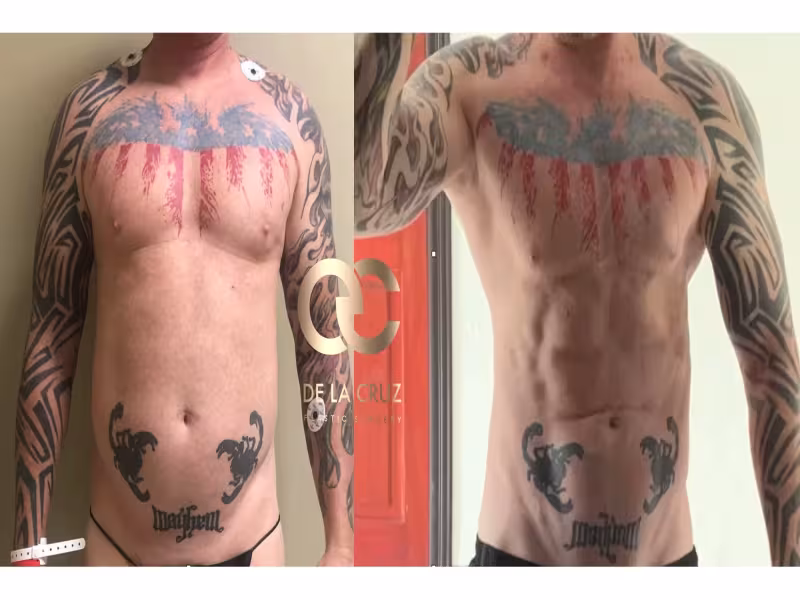 Houston Surgeon Blends Classical Sculpture With Body-Contouring Surgery